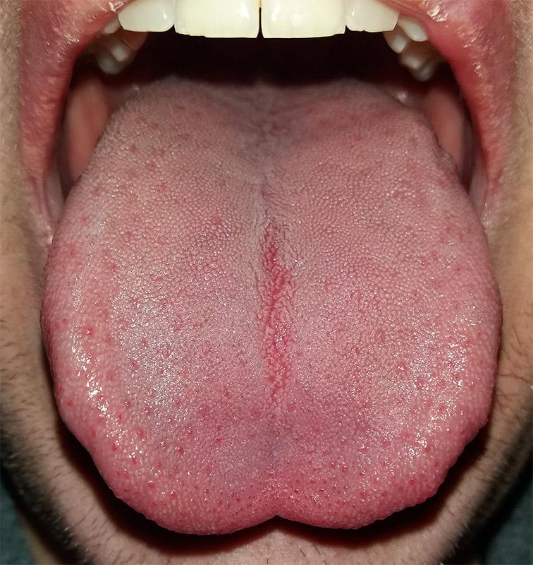 Tongue - Wikipedia