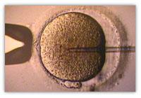 Fécondation in vitro — Wikipédia