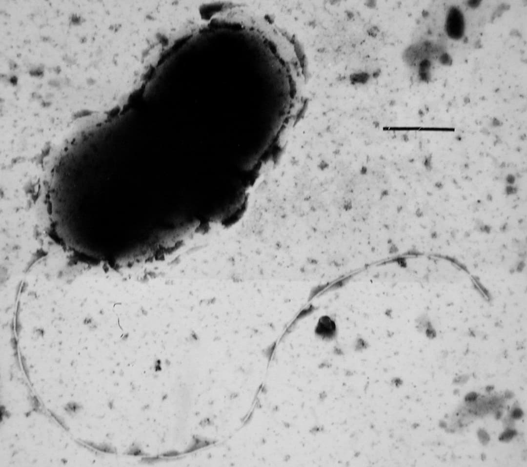 Sulfate-reducing microorganism - Wikipedia