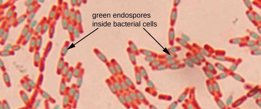 Endospore staining - Wikipedia