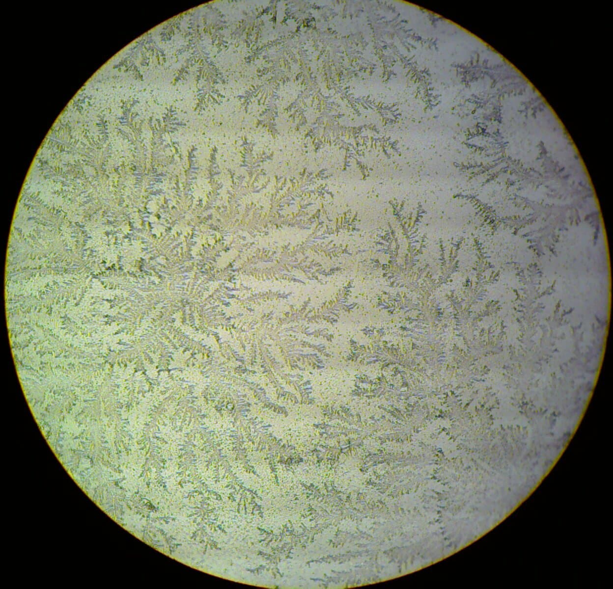 Prelabor rupture of membranes - Wikipedia