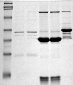 Polyacrylamide gel electrophoresis - Wikipedia