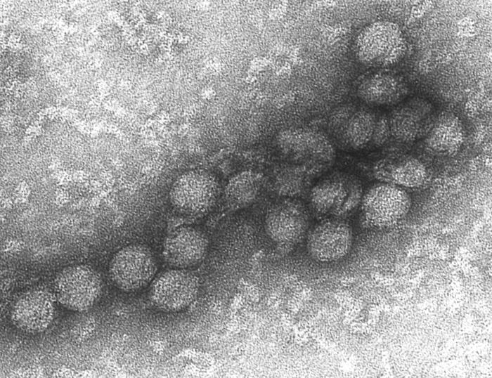 Virus du Nil occidental — Wikipédia