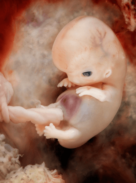 Prenatal development - Wikipedia