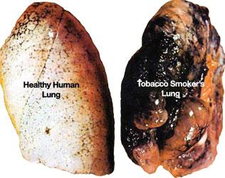 Smoking cessation - Wikipedia