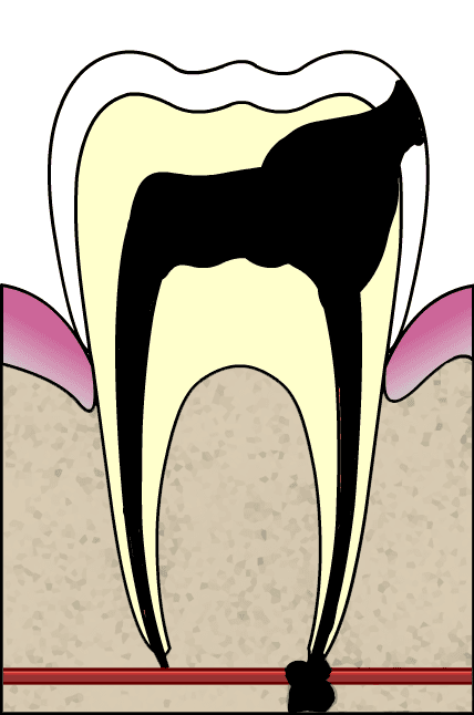 Pulpite — Wikipédia