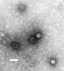 Poliovirus - Wikipedia