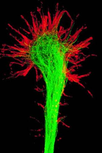 Growth cone - Wikipedia