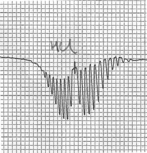 Spectroscopie rotationnelle — Wikipédia