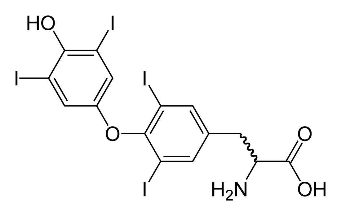 Hypothyroidism - Wikipedia