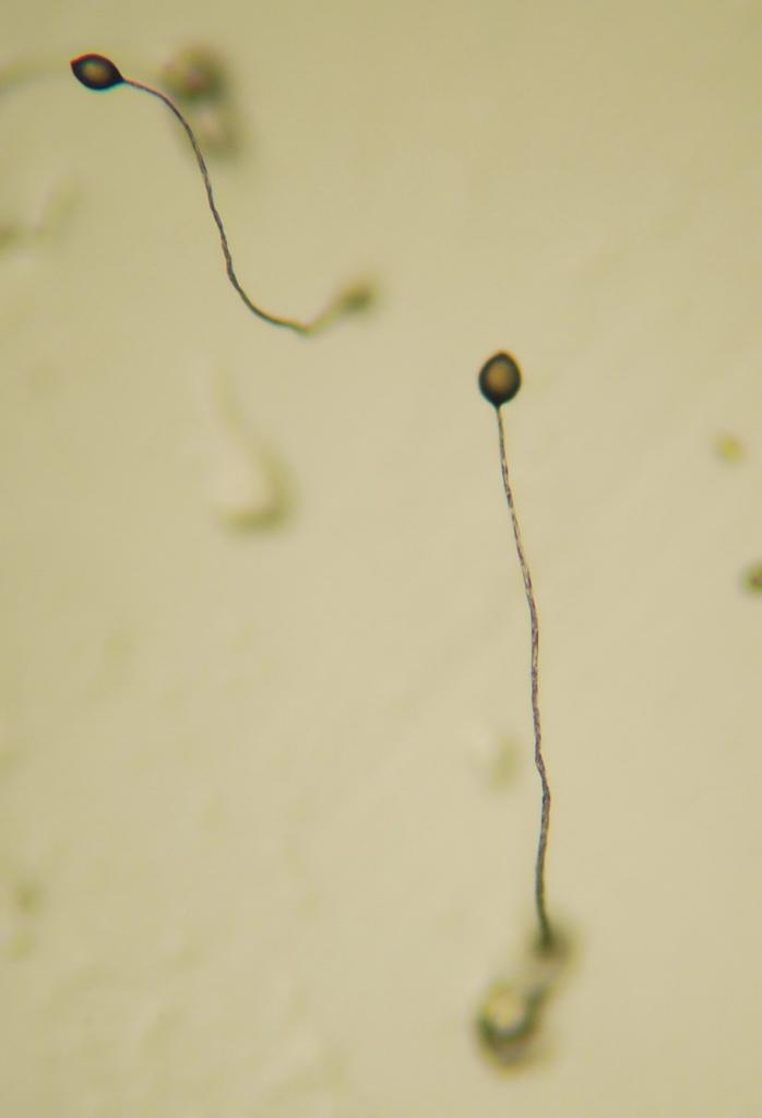 Dictyostelium discoideum - Wikipedia