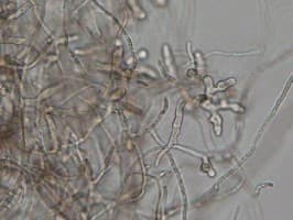 Pythium — Wikipédia