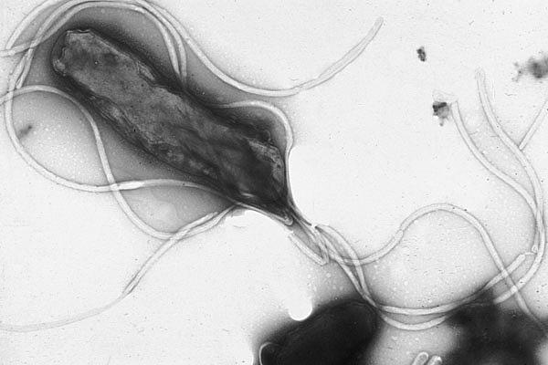 Helicobacter pylori - Wikipedia