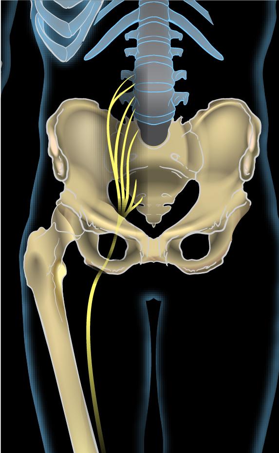 Sciatic nerve - Wikipedia