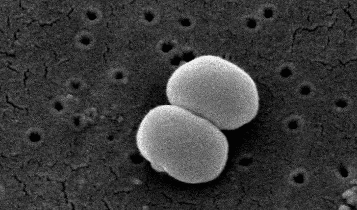 Staphylococcus epidermidis - Wikipedia