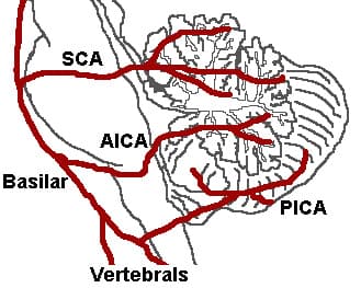 Syndrome d'enfermement — Wikipédia