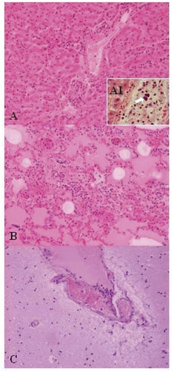 Lactic acid bacteria - Wikipedia