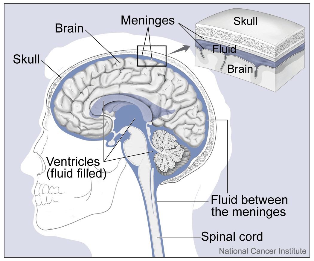 Aseptic meningitis - Wikipedia