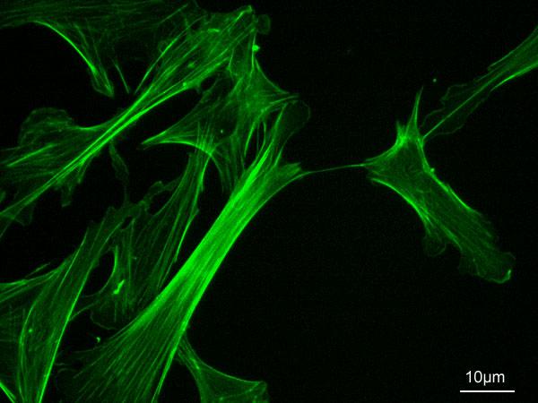 Microfilament - Wikipedia