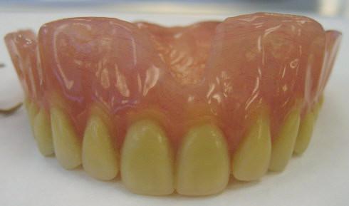 Dentures - Wikipedia