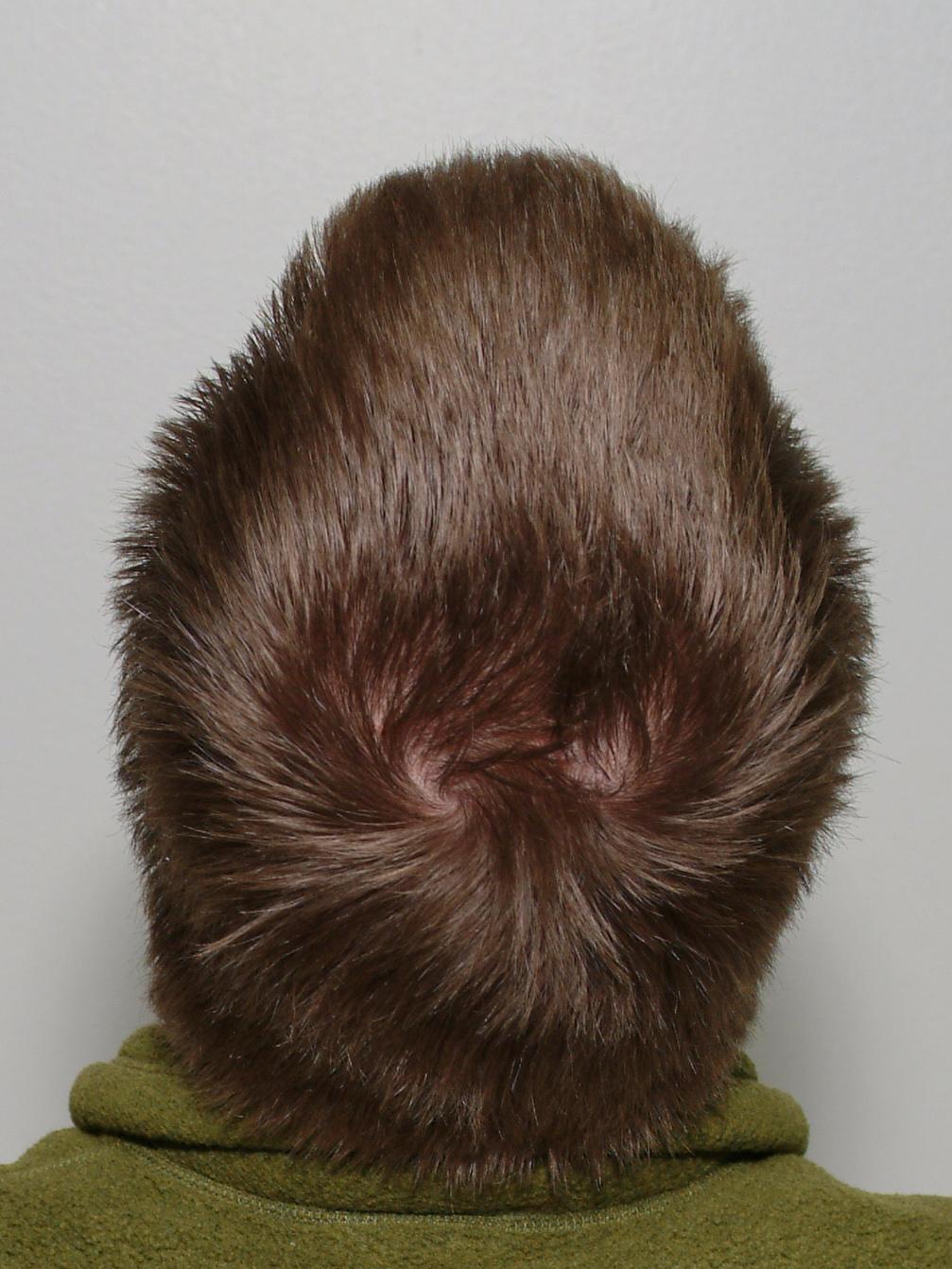 Scalp - Wikipedia