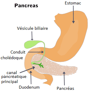 Pancréatite aiguë — Wikipédia