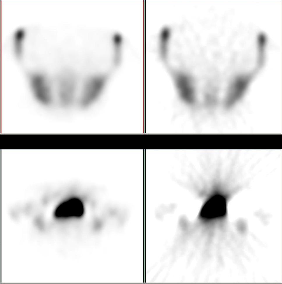 Iterative reconstruction - Wikipedia