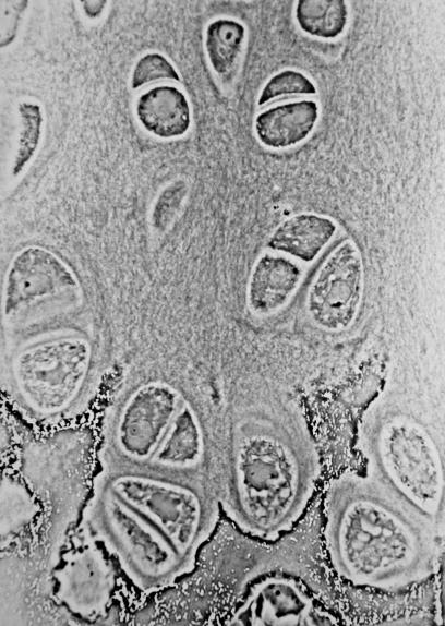 Chondrocyte - Wikipedia