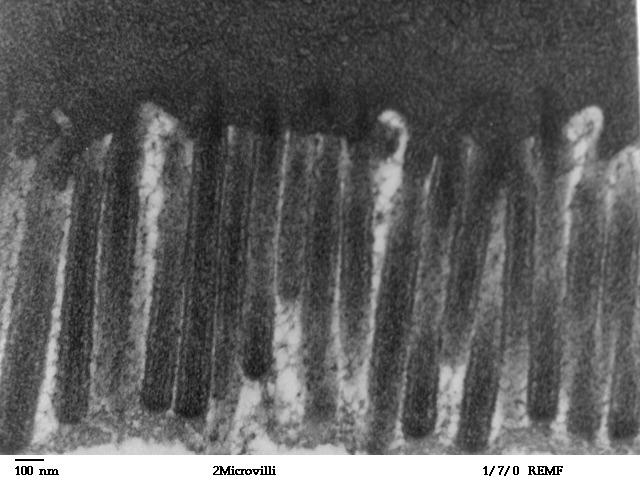 Microvillus - Wikipedia