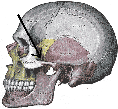 Zygomatic arch - Wikipedia