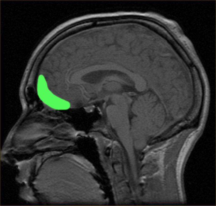 Orbitofrontal cortex - Wikipedia