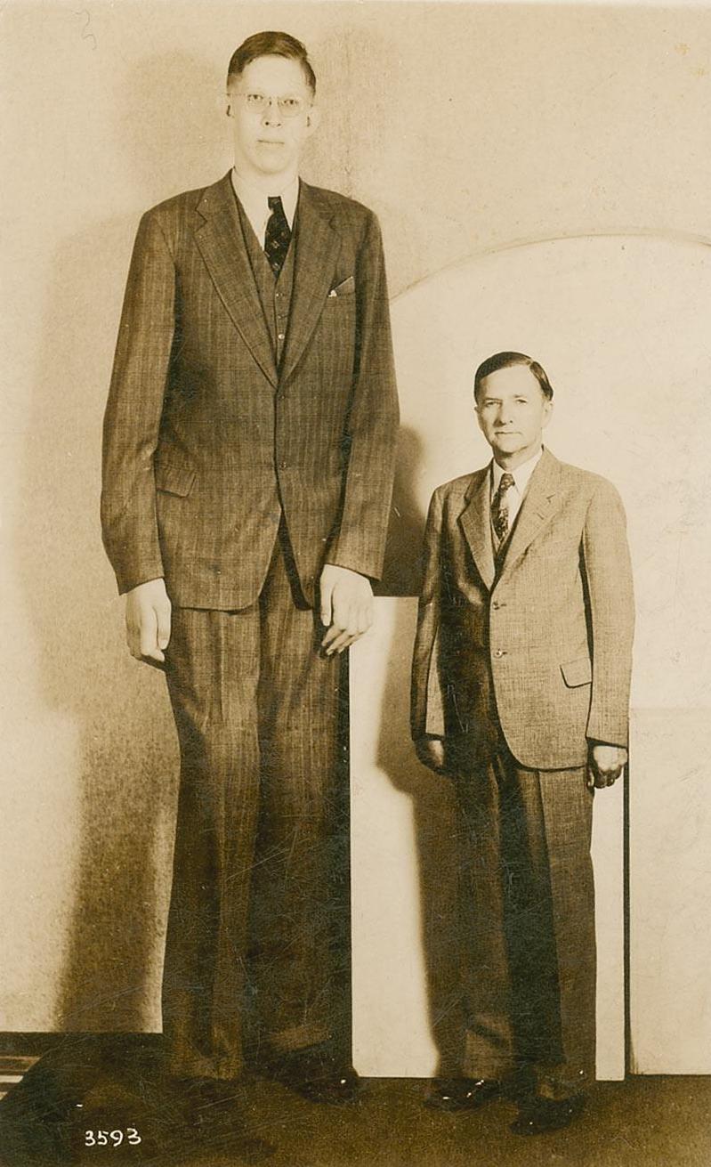 Gigantism - Wikipedia