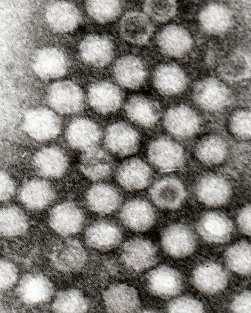 Virus adéno-associé — Wikipédia