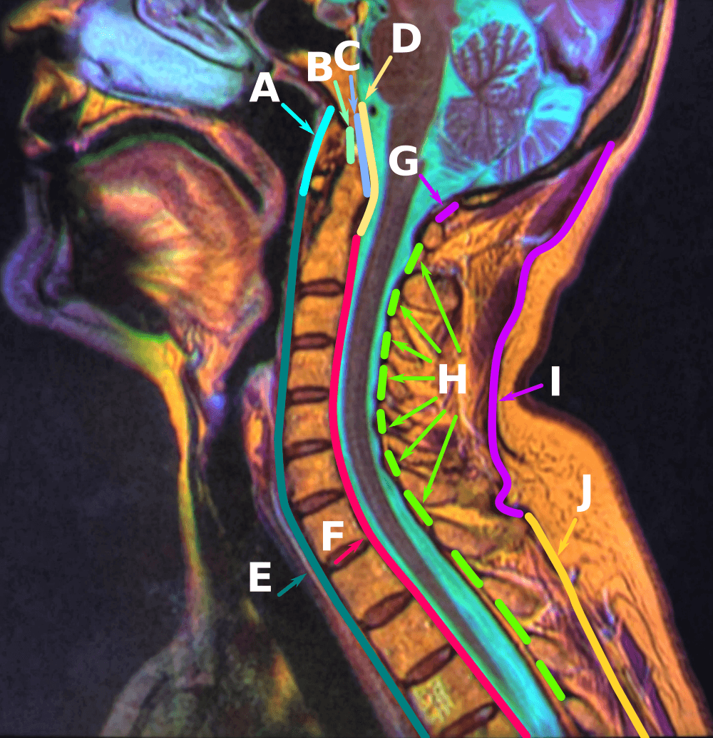 Ligament longitudinal antérieur — Wikipédia