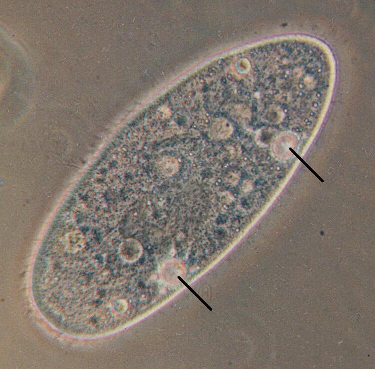 Contractile vacuole - Wikipedia