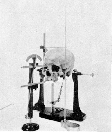 Craniométrie — Wikipédia