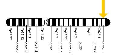 Syndrome de l'X fragile — Wikipédia