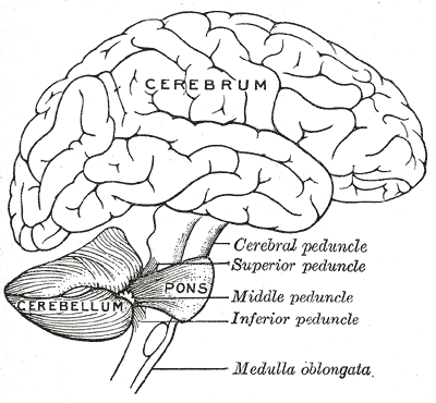 Cerebellar hypoplasia - Wikipedia