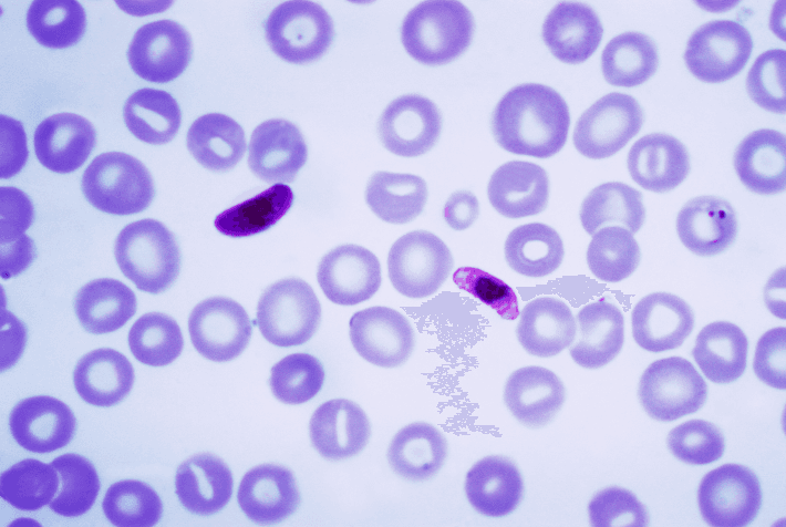 Plasmodium falciparum - Wikipedia