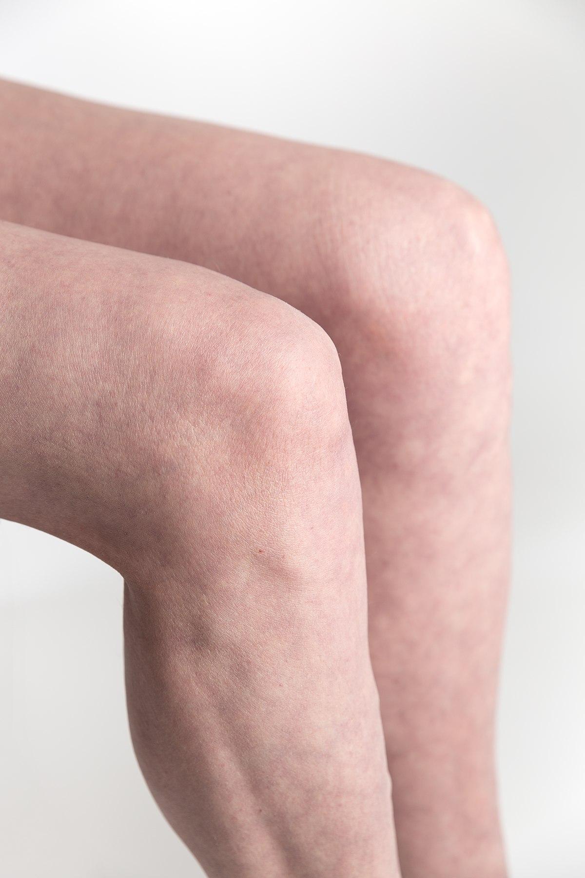 Knee - Wikipedia