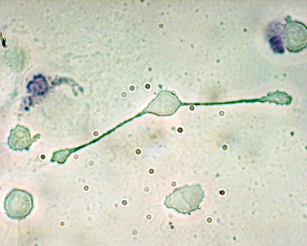 Macrophage — Wikipédia