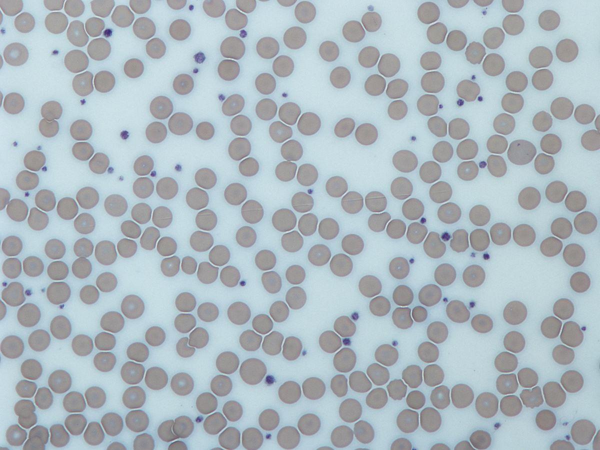 Platelet - Wikipedia