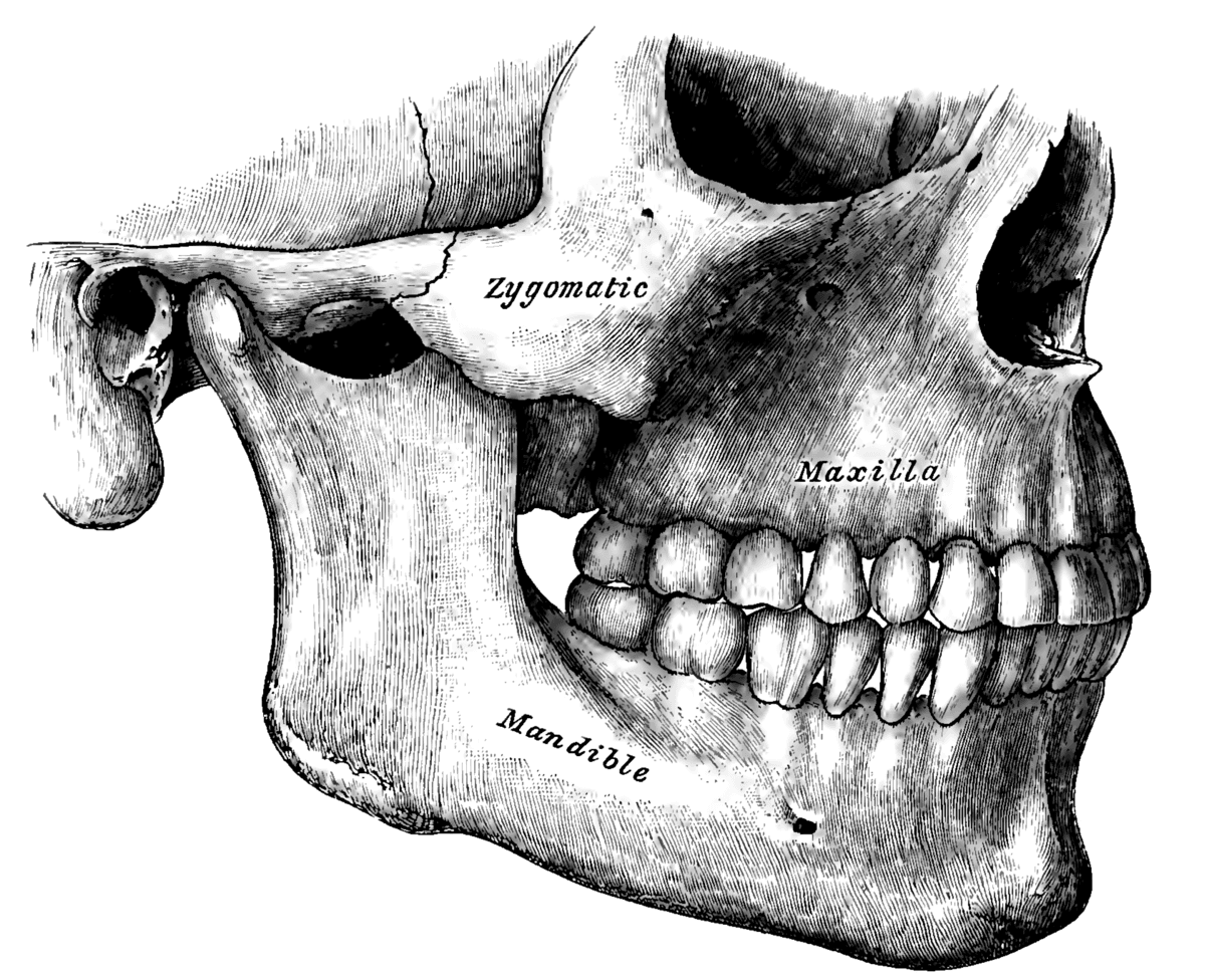 Chirurgie orthognathique — Wikipédia