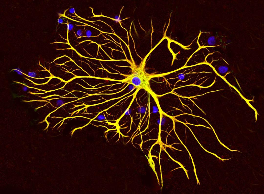 Astrocyte - Wikipedia