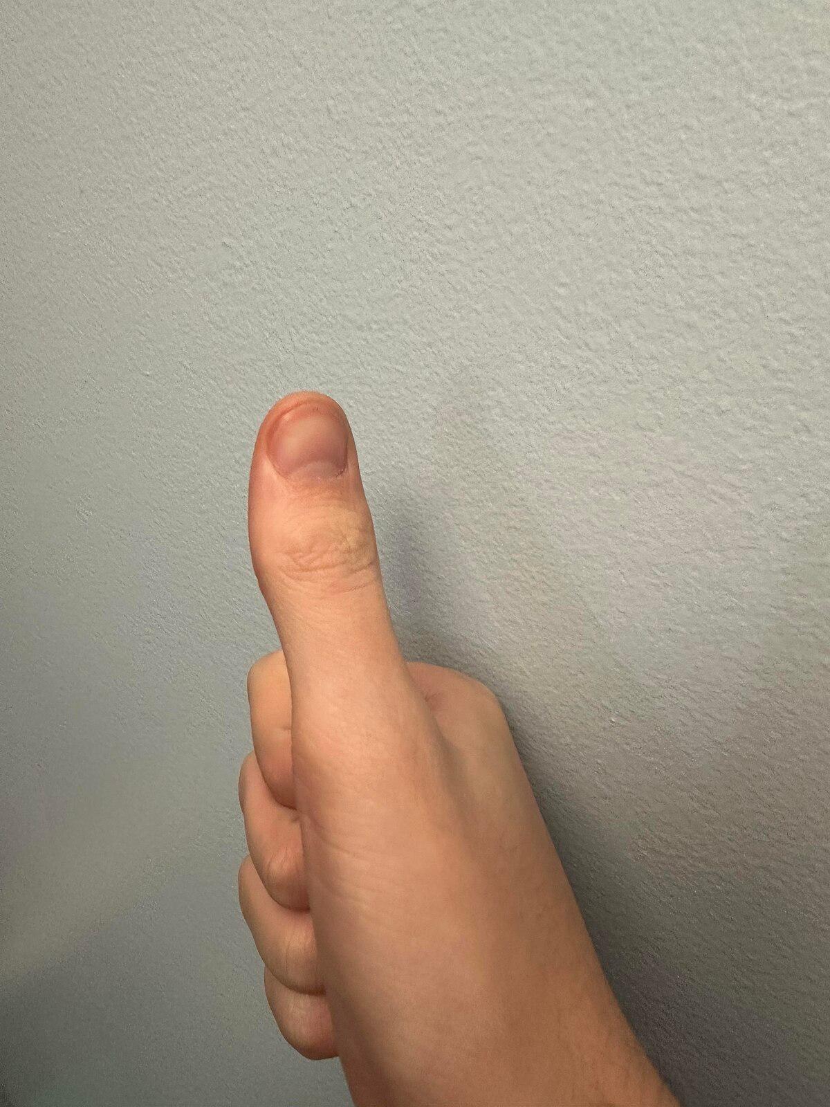 Thumb - Wikipedia