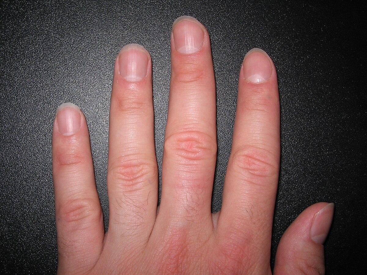 Nail (anatomy) - Wikipedia