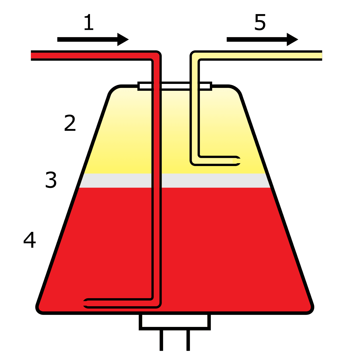 Apheresis - Wikipedia