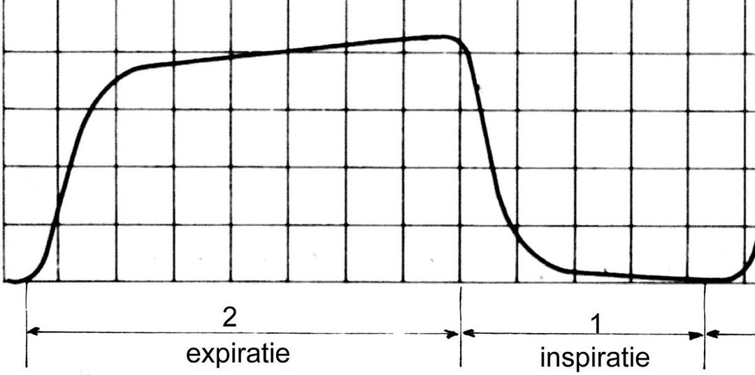 Capnographie — Wikipédia