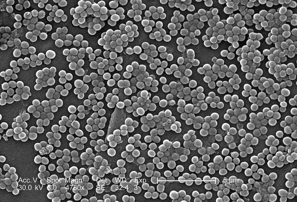 Staphylococcus aureus résistant à la méticilline — Wikipédia