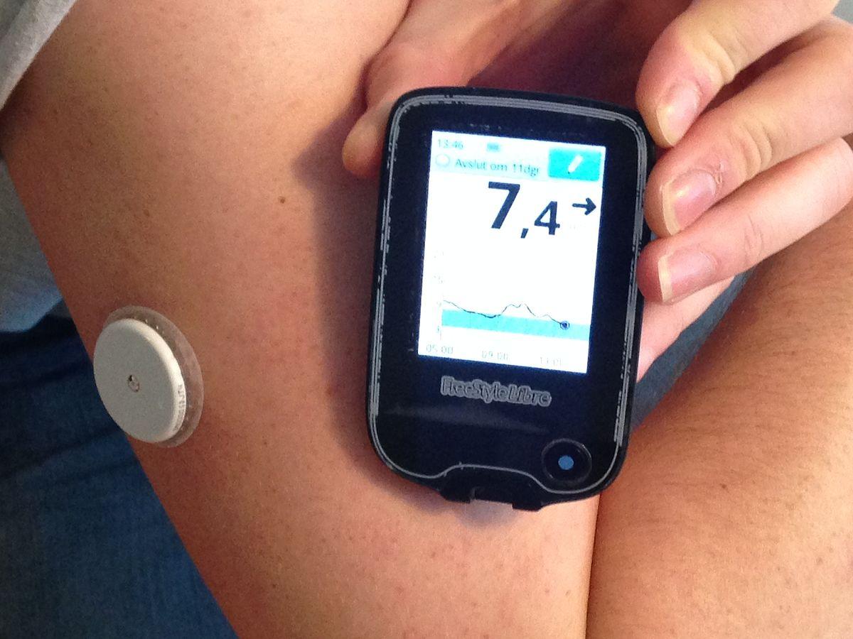 Continuous glucose monitor - Wikipedia